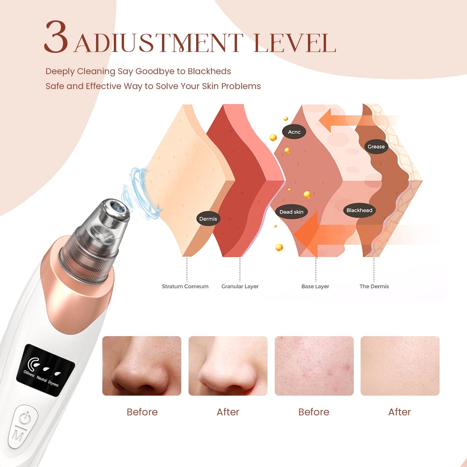 2025 Blackhead Remover Pore Vacuum,Facial Pore Cleaner - 5 Suction Power,5 Probes,USB Rechargeable Blackhead Vacuum Kit Electric Acne Extractor Tool for Adult - eighttwentytwo92